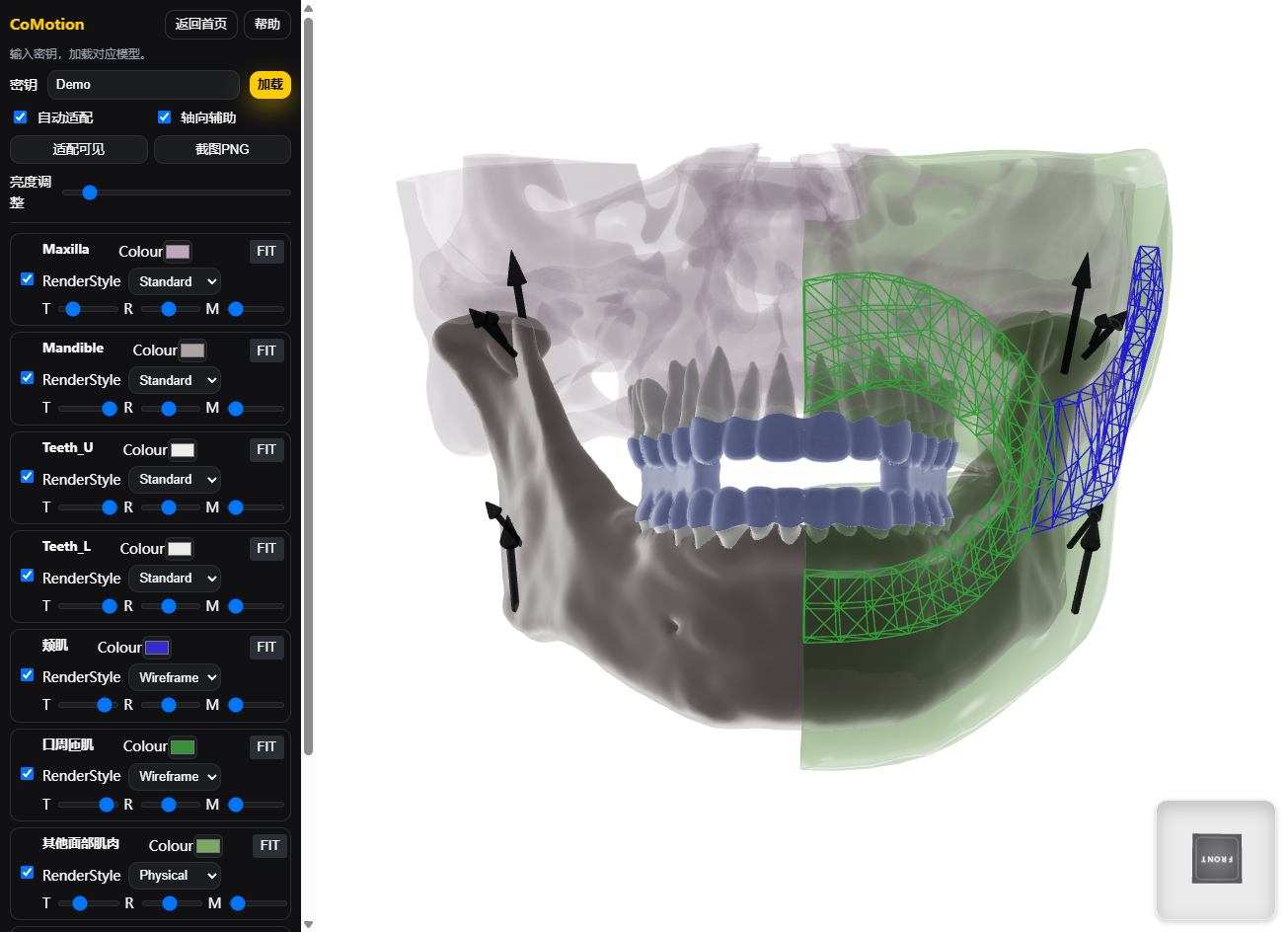 CoMotion 截图占位